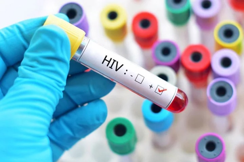 Corte de verba dos EUA para programa de HIV pode comprometer tratamento em países em desenvolvimento, alerta OMS