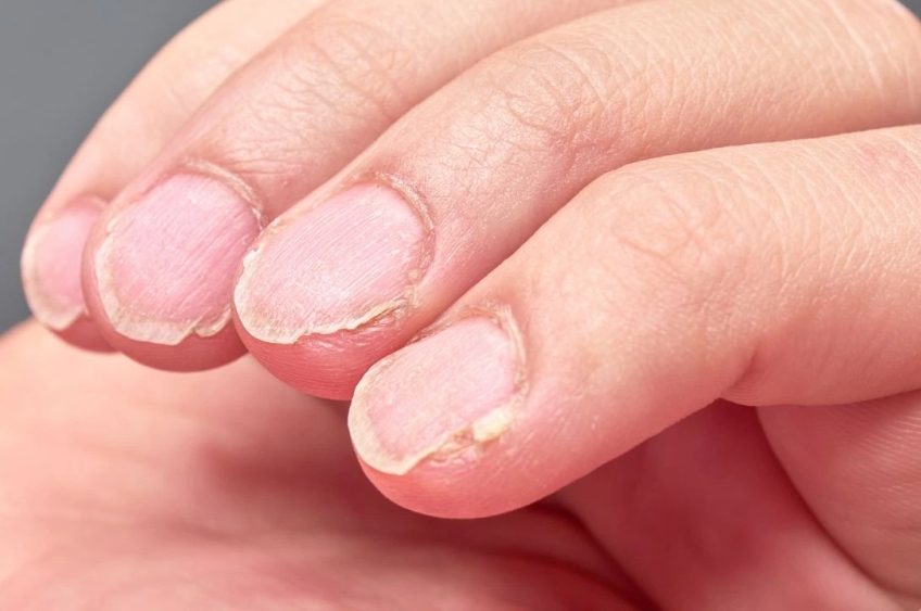 Unhas: o que elas revelam sobre a saúde e por que merecem mais atenção